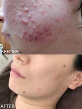 ビアンカ/お客様のお声