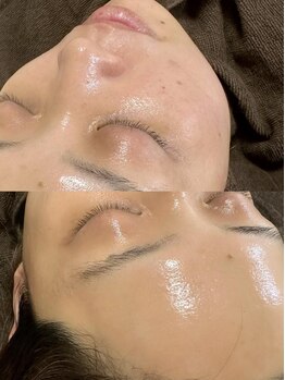 シュ シュ(chou chou)の写真/産毛ケアとピーリングを行うFWT潤艶(うるつや)ワックスで透明感と潤いのある肌に導きます♪