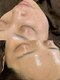 シュ シュ(chou chou)の写真/産毛ケアとピーリングを行うFWT潤艶(うるつや)ワックスで透明感と潤いのある肌に導きます♪