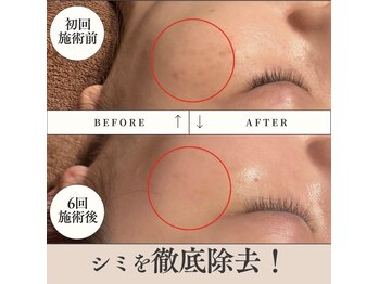 ラ リリー ステラ(La Lily stella)