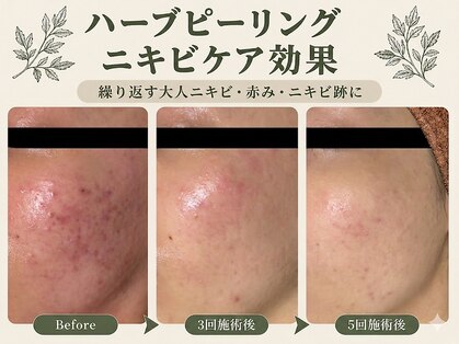 スイ 昭島店(Sui)の写真