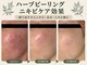スイ 昭島店(Sui)の写真