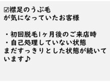 ニコ アンド キャンディー(Nico.&Candy)/本気の脱毛！効果を出したい方！