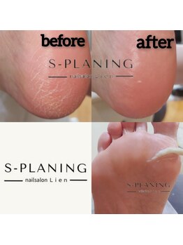 ネイルサロン リアン西葛西店/韓国式足裏ケアエスプランニング