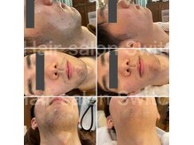 ヘアー サロン スイッチ(Switch)の雰囲気（高機能【脱毛器】男女問わず喜ばれてます。うなじ／ヒゲなど対応）