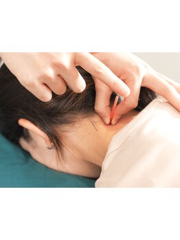 鍼灸施術を受けたい