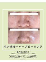 ソワナ(soina)/【神楽坂駅/フェイシャル/毛穴】