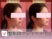 美妖庵の雰囲気（人気No.1！骨格から変わる小顔矯正！技術に納得して施術してます）