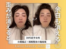 ルルラボ(LuLu beauty labo)/歪みリセットで自然な小顔へ
