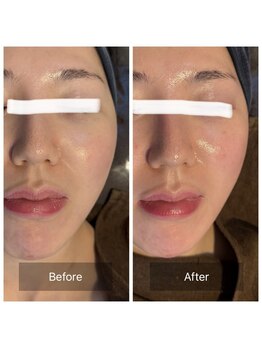 ラビ(RABBI)/30代女性レモンボトル小顔