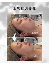 エムボーテ 太田店(M BEAUTE33)/顔筋小顔コルギ
