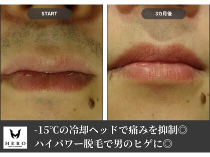ヒーロー 大名(HERO)の写真