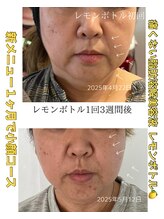 グラシュ(Gracieux)/韓国発脂肪撃退！レモンボトル