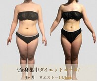 サンテボーテ(Sante Beaute)