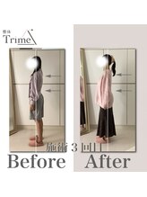 トライム(Trime)/姿勢B/A 2