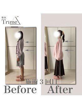 トライム(Trime)/姿勢B/A 2