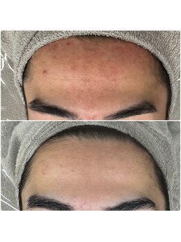 ラウレア(Laule'a)/メンズ美容☆美容男子