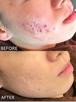 ビアンカ/お客様のお声