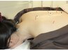 【回数券用】美容鍼+オーダーメイド鍼灸75分　5回回数券