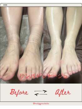 サロン ド マロン(Salon de Marron)/むくみ改善☆リンパマッサージ