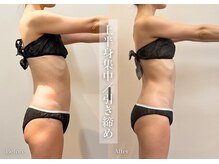 シューラディアント(ShuRadiant)/ブライダル/痩身