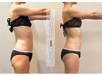 シューラディアント(ShuRadiant)/ブライダル/痩身