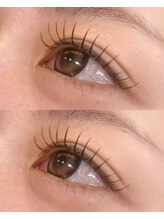 タイド バイ ホープ(tied by Hope)/【Wフラット100本】