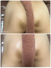 シャナ(Shana)/カーボキシーボディ(お尻)