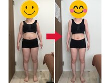 美容整体院元 光の森店/40代　H.I様の喜びの声