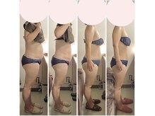 アクア エステティコ 亀有(ACQUA estetico)/脂肪燃焼 腹部 50代　4ヶ月経過