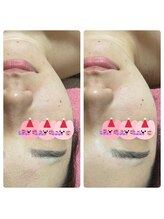 紫檀(シタン)/オーダーフェイシャル