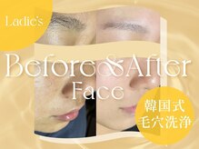 クリアラボ 豊中(Clear Lab)/Before&After