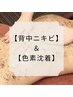 【ボディニキビケア】美容外科提携リベルハーブピーリング￥33000→¥22000