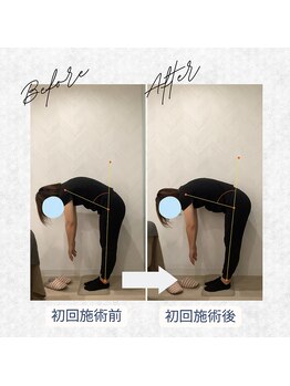 ラクリエ 東加古川院(La Creer)/お客様ビフォーアフター