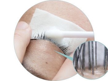 チャーム 四条烏丸(Charm)/毛穴洗浄☆アイスパ