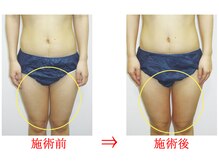 東京美容整体/ダイエット痩身 20代女性
