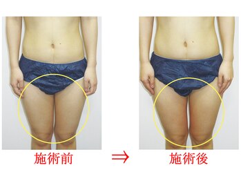 東京美容整体/ダイエット痩身 20代女性