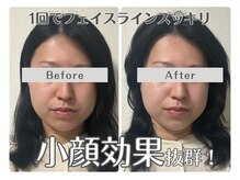 ルリアン(Lurian)/エステ1回でのBefore→After