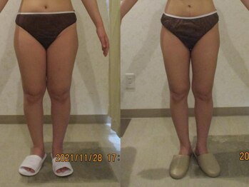 プロラボスパ 倉敷店/30代前半　症例写真