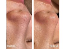 チェンジ 小山店(Change)/