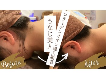 チャンティック(Cantik)/うなじケア