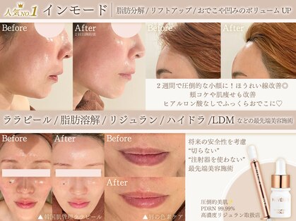 ミーカラー(mecalla.)の写真