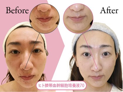 クリニカルエステ/イーズ 六甲アイランド店の写真