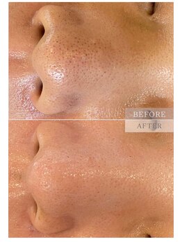 パールブルー(All Perl blue)/キュラハのエステ