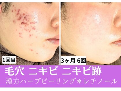 おうちサロン ミキの写真