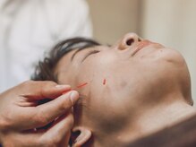 鍼灸からだケア 元住吉 ［肩凝り・腰痛改善/もみほぐし・ストレッチ・リンパ・整体］の雰囲気（長年の修行経験もあり◎本格派の鍼施術！初めての方にもオススメ）