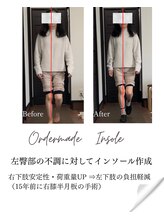 ミヤビ(MIYABI)/腰の痛みにインソール