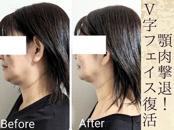 スウ(suu.)/Before-After【40代】8 回