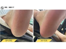 ふっとけ庵/足裏角質ケア