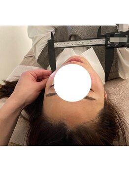 ユウサク(Yusaku)/【小顔矯正/美容鍼/本町/梅田】